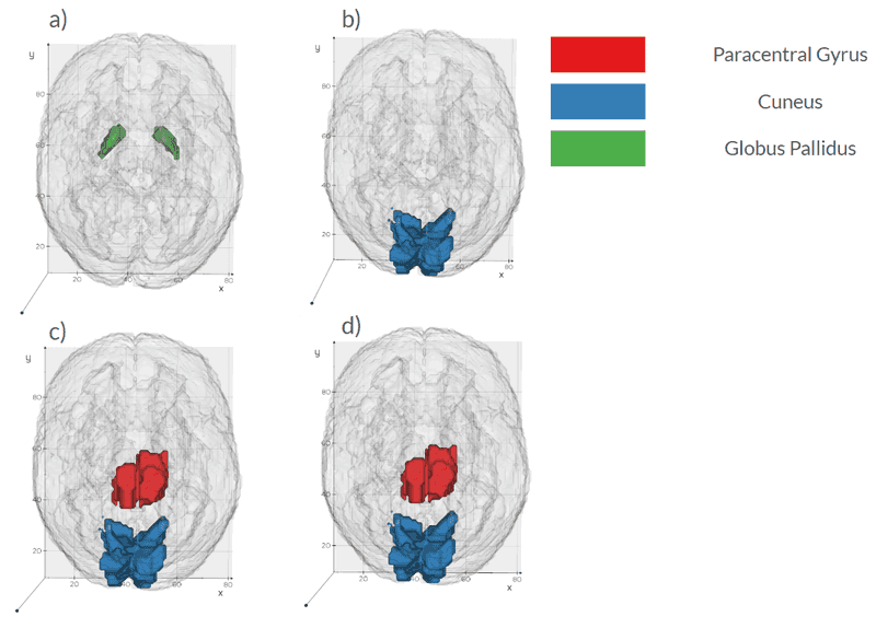 Representative subgroup-specific imaging markers