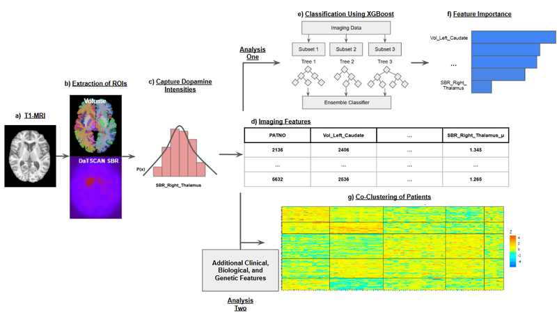 Analysis workflow for DaT and MRI features