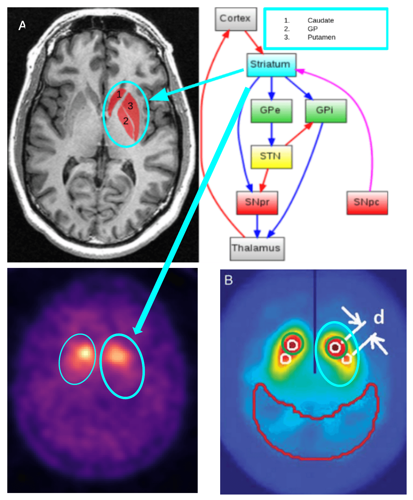 Diagram pointing to different sections of the brain