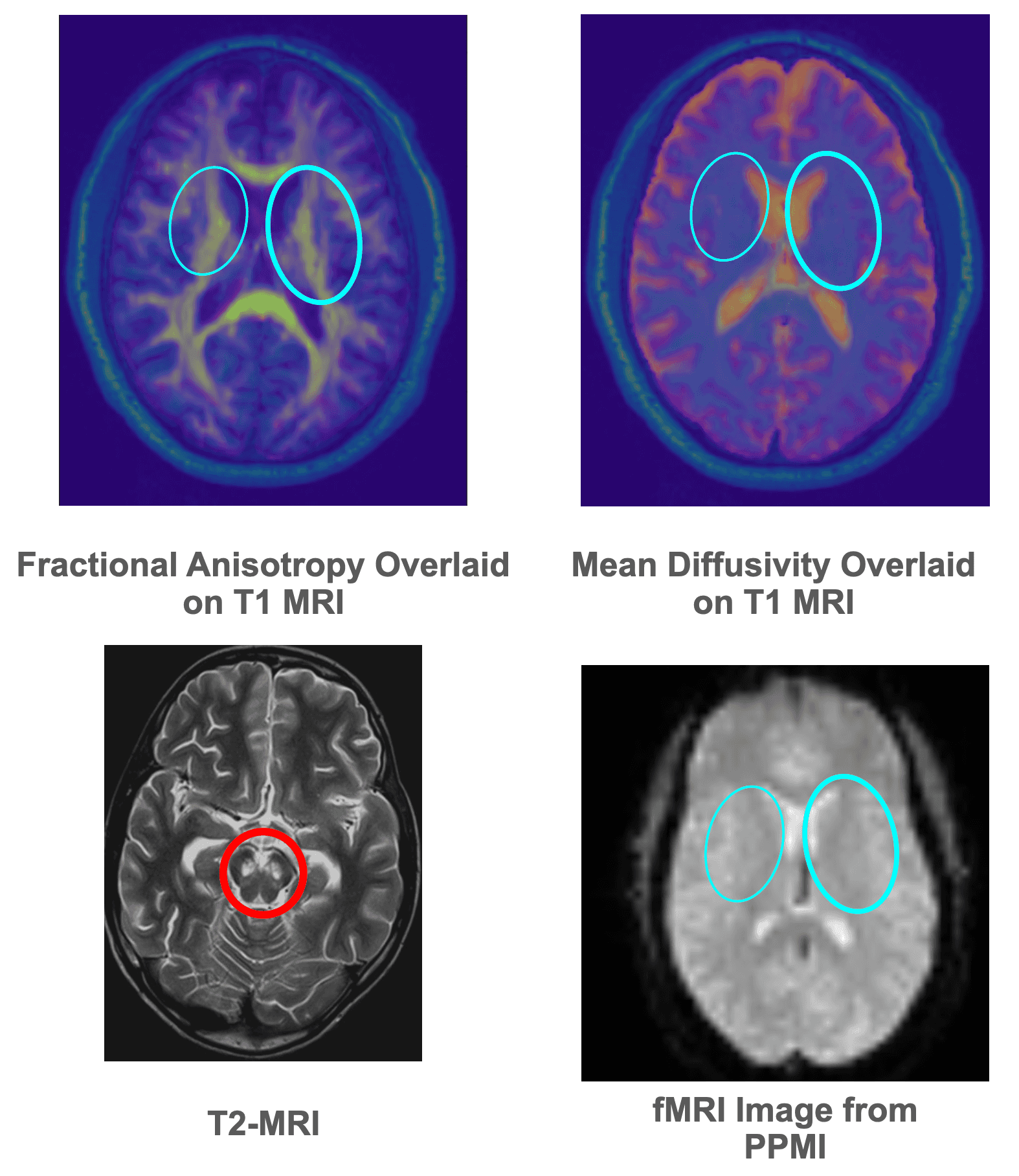 DTI images with overlays