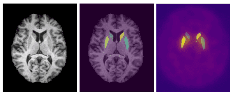 Overview of Segformer Process