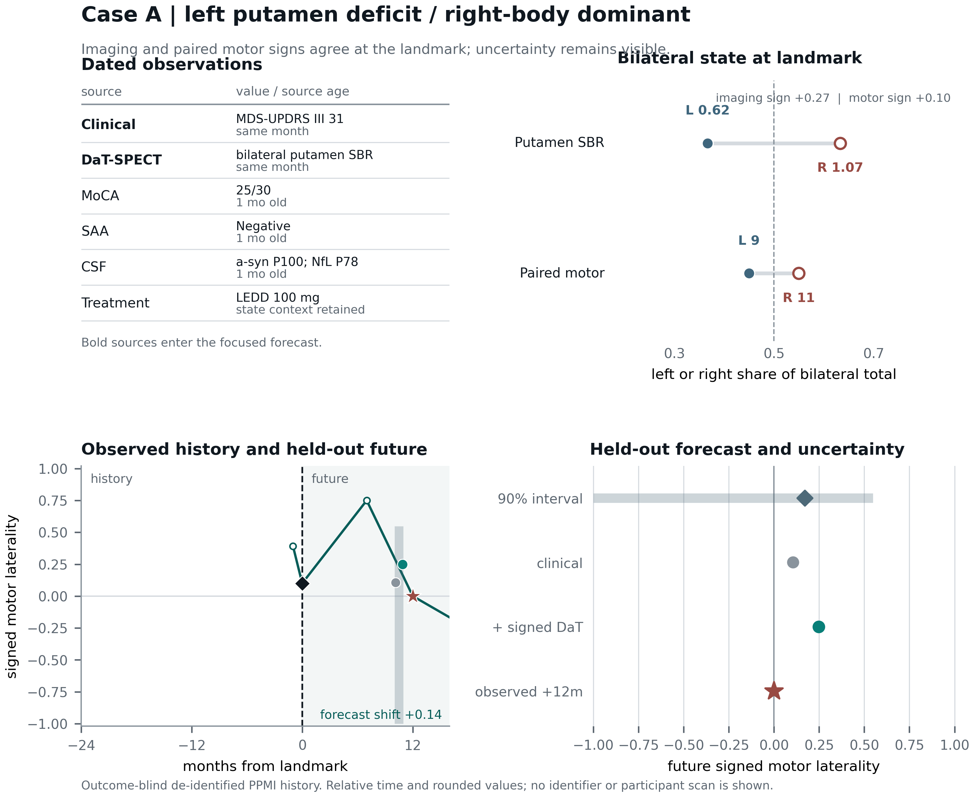Case A dated sources, bilateral state, observed motor laterality, and held-out uncertainty