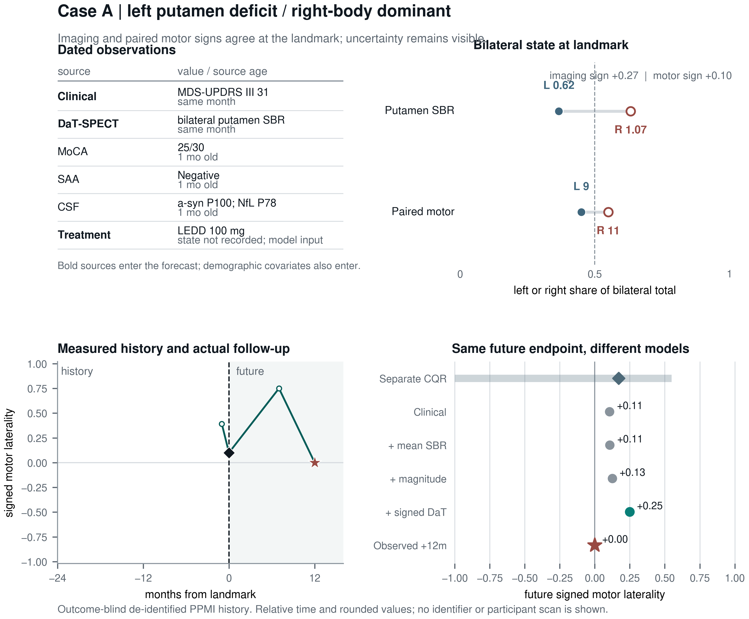 Case A dated sources, bilateral state, observed motor laterality, and held-out uncertainty