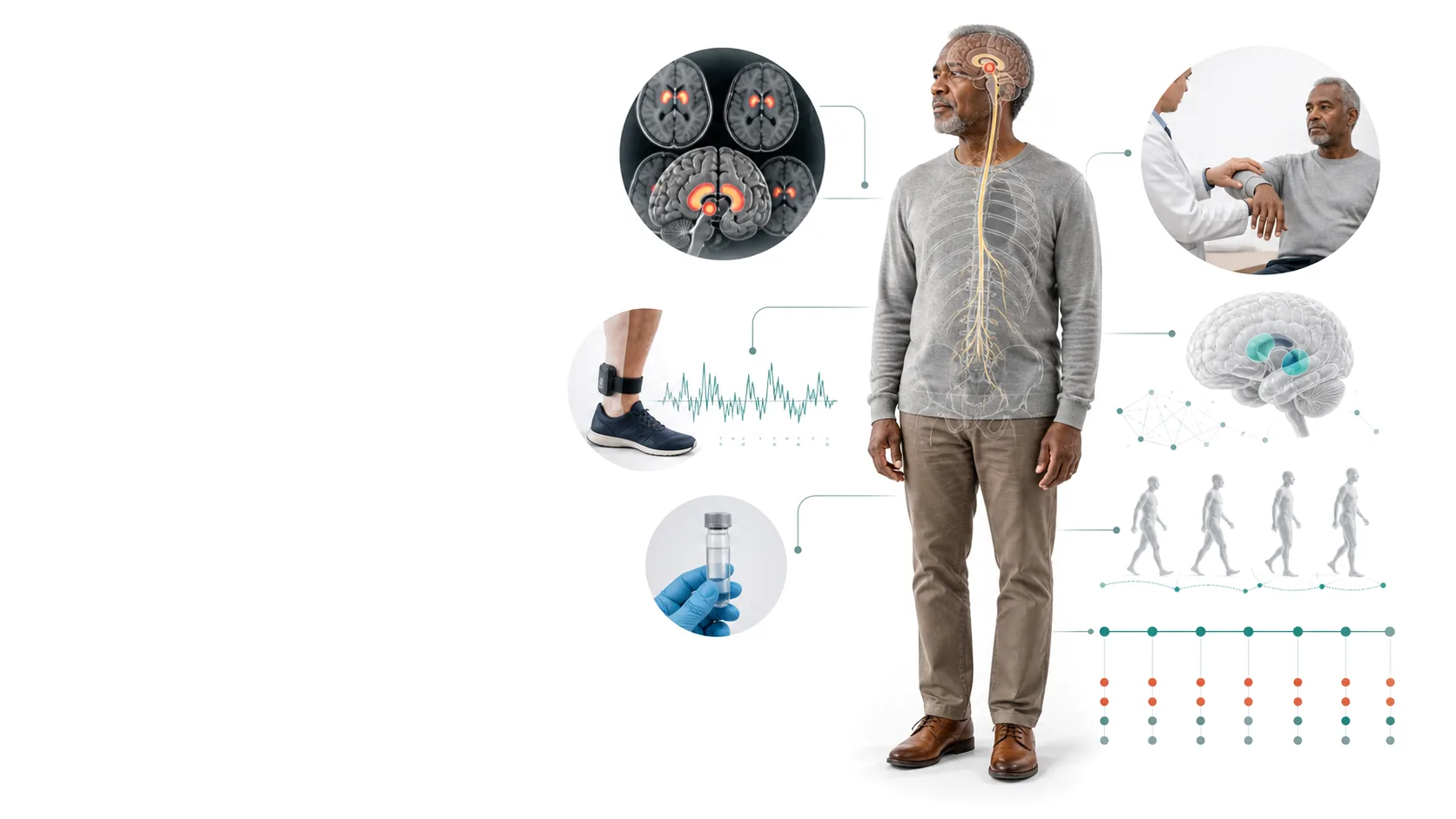 Conceptual adult participant surrounded by clinical examination, DaT-SPECT, wearable gait, biomarker, brain, and longitudinal evidence