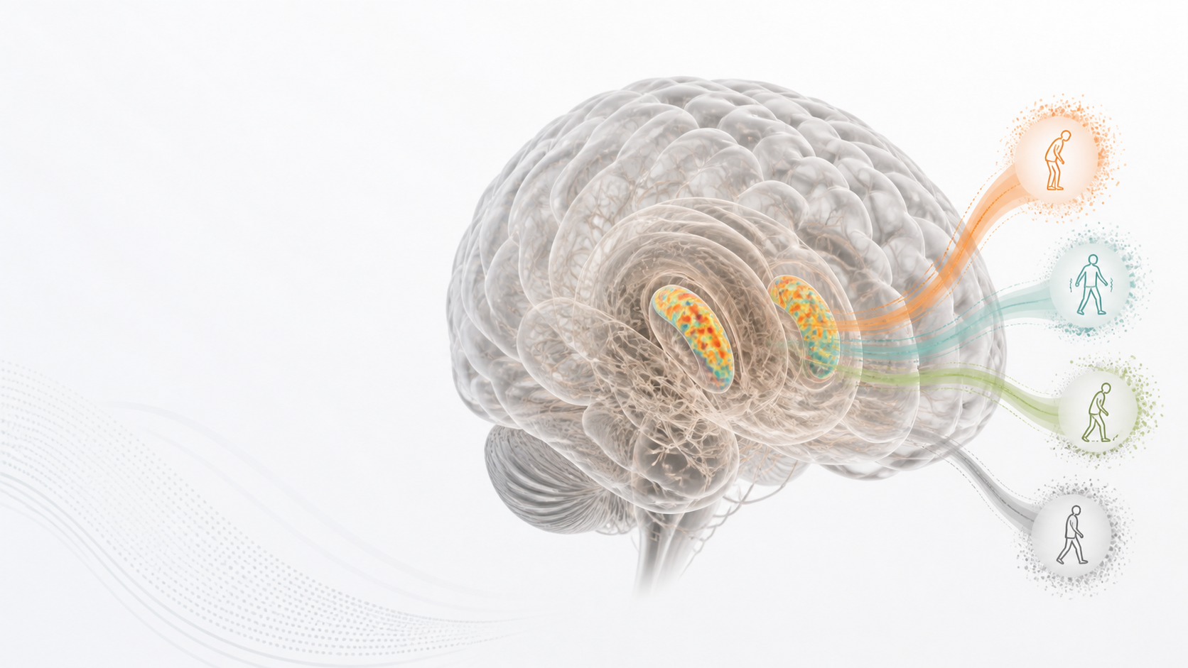 Generated scientific visualization of a transparent brain with posterior motor-state ribbons.
