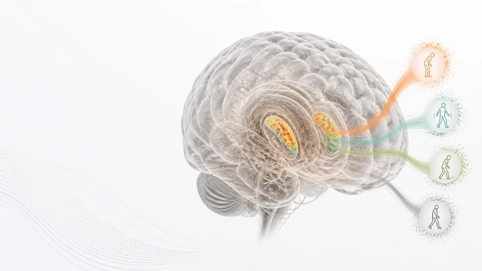 Generated scientific visualization of a transparent brain with posterior motor-state ribbons.